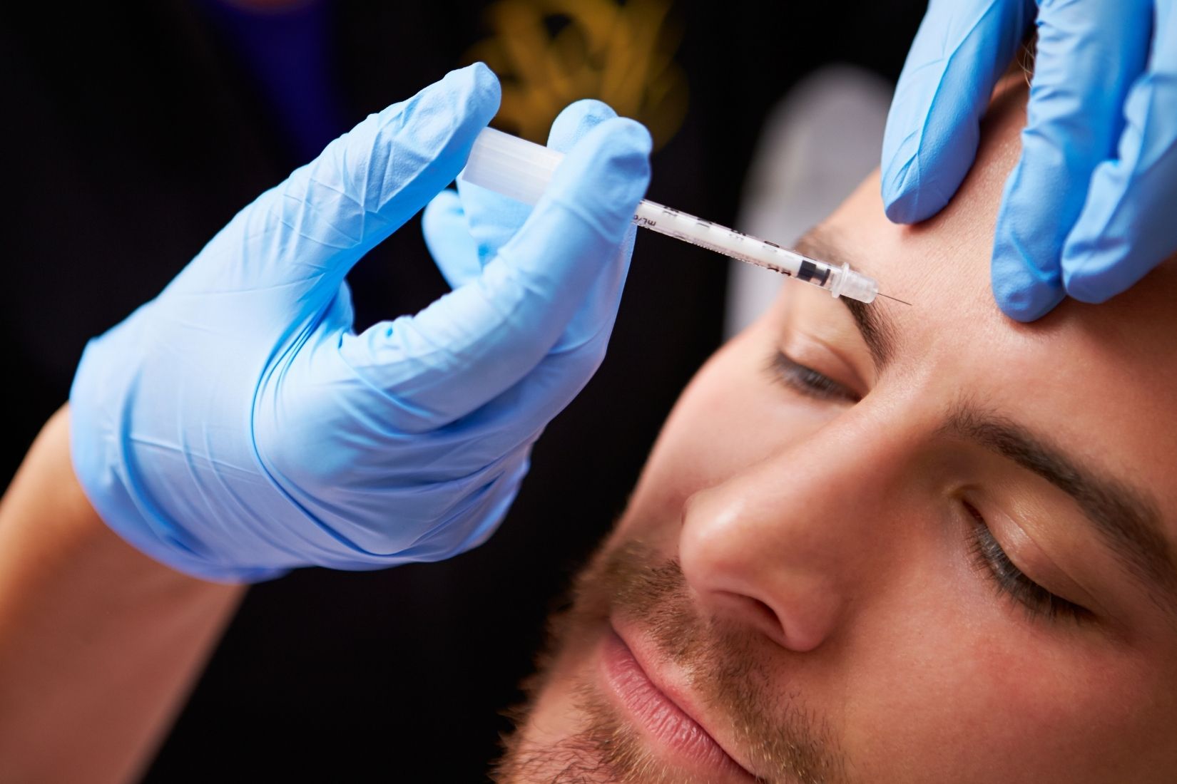 Erkek yüz anatomisinde alın, kaş arası ve göz çevresi mimik analizini gösteren medikal estetik görsel