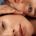 Ağız köşelerinden çene hattına uzanan marionette çizgilerinin yüz anatomisindeki konumunu gösteren medikal görsel.