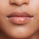 Burun tabanı ile üst dudak arasındaki philtrum, filtrum kolonları ve Cupid’s bow anatomisini gösteren medikal görsel.