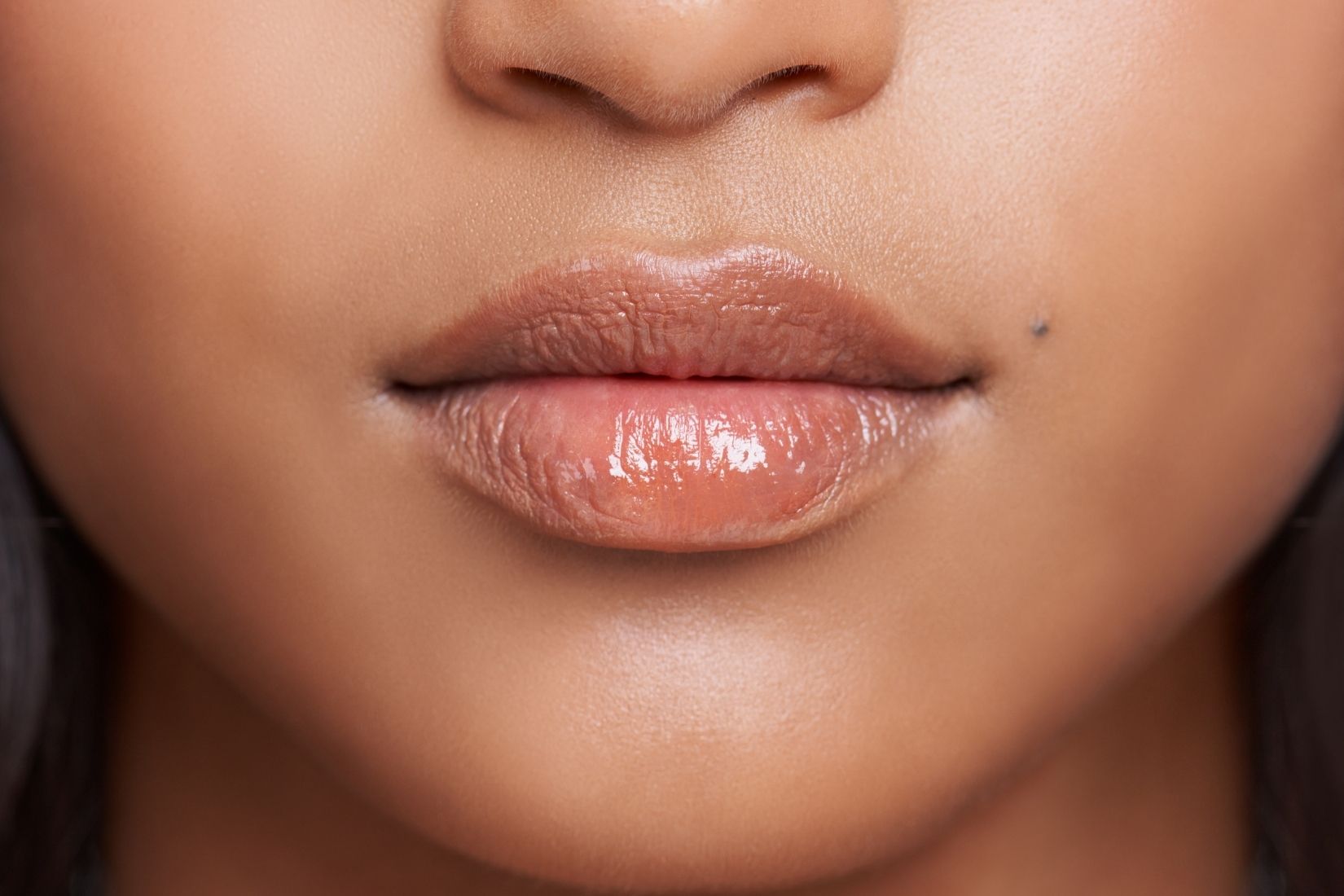 Burun tabanı ile üst dudak arasındaki philtrum, filtrum kolonları ve Cupid’s bow anatomisini gösteren medikal görsel.