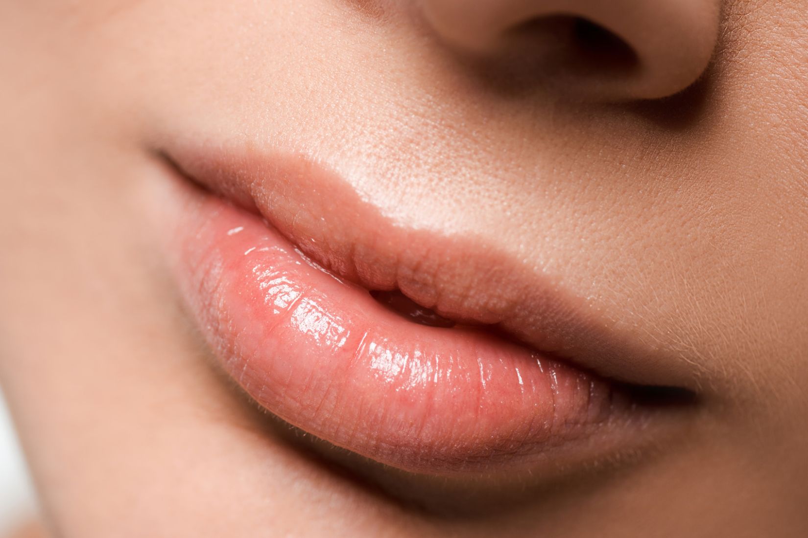 Russian Lips dudak dolgusu değerlendirmesinde üst ve alt dudak anatomisi, Cupid yayı ve dudak konturlarını gösteren çizim.