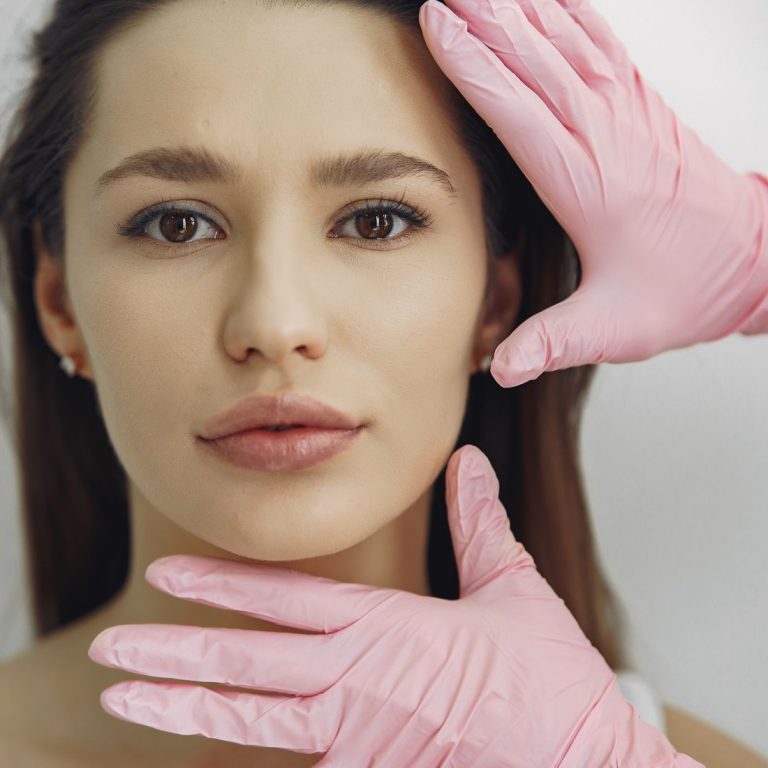 İple yüz germe uygulamasında cilt altına yerleştirilen askı ipleri