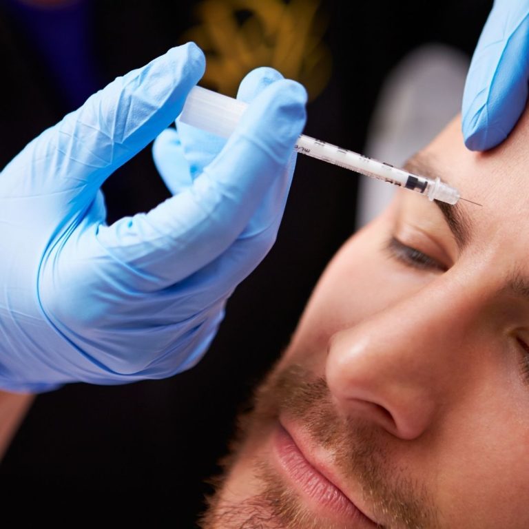 Erkek yüz anatomisinde alın, kaş arası ve göz çevresi mimik analizini gösteren medikal estetik görsel
